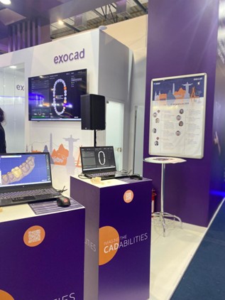 Notebooks Avell com Exocad em funcionamento no estande da Exocad